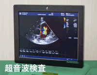 超音波検査写真
